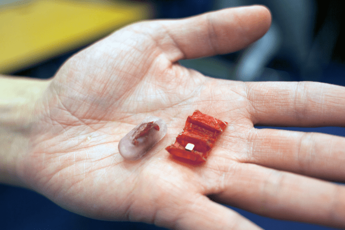 The Evolution of Medical Robotics: Unpacking the Pig-Inspired Battery Retrieval System