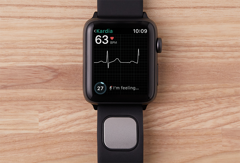 Revolutionizing Heart Health: The Kardiaband and Its Impact on Wearable Technology