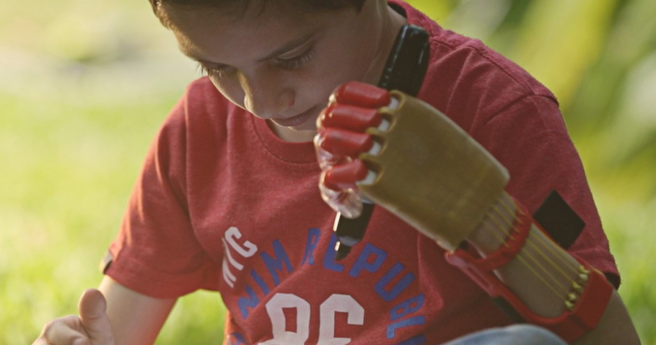 Revolutionizing Prosthetics: The Po Initiative in Paraguay