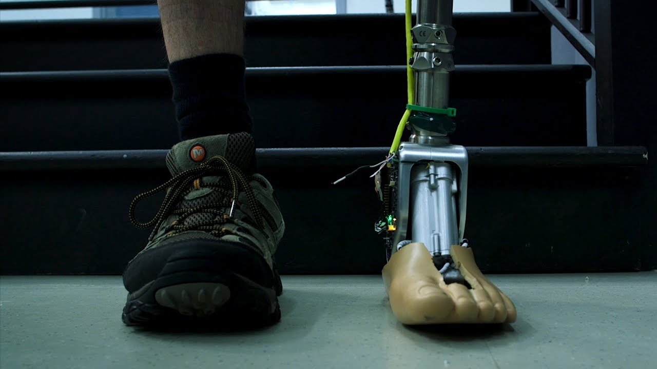 The Future of Mobility: Adaptive Prosthetic Ankles Redefining Motion