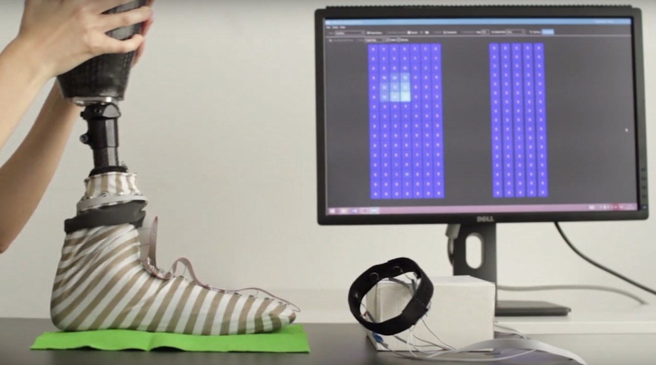 Revolutionizing Prosthetics: The Power of Sensory Socks