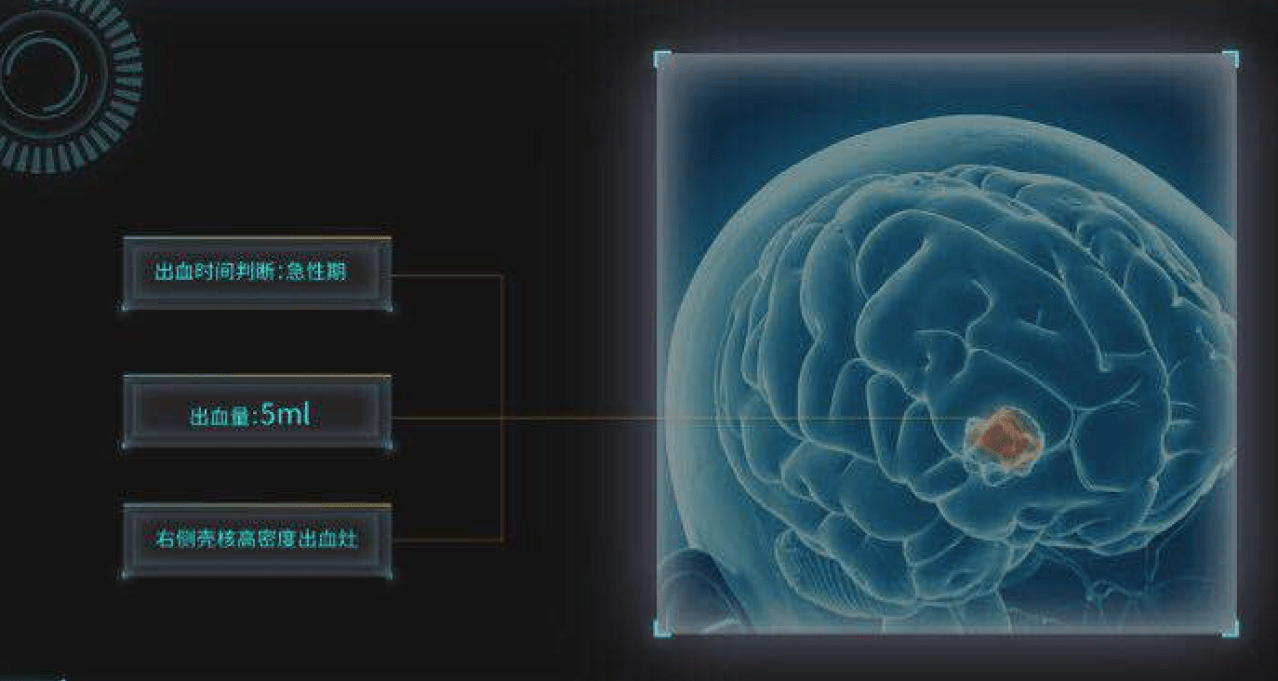 AI Revolutionizing Healthcare in China: The Journey of 12 Sigma