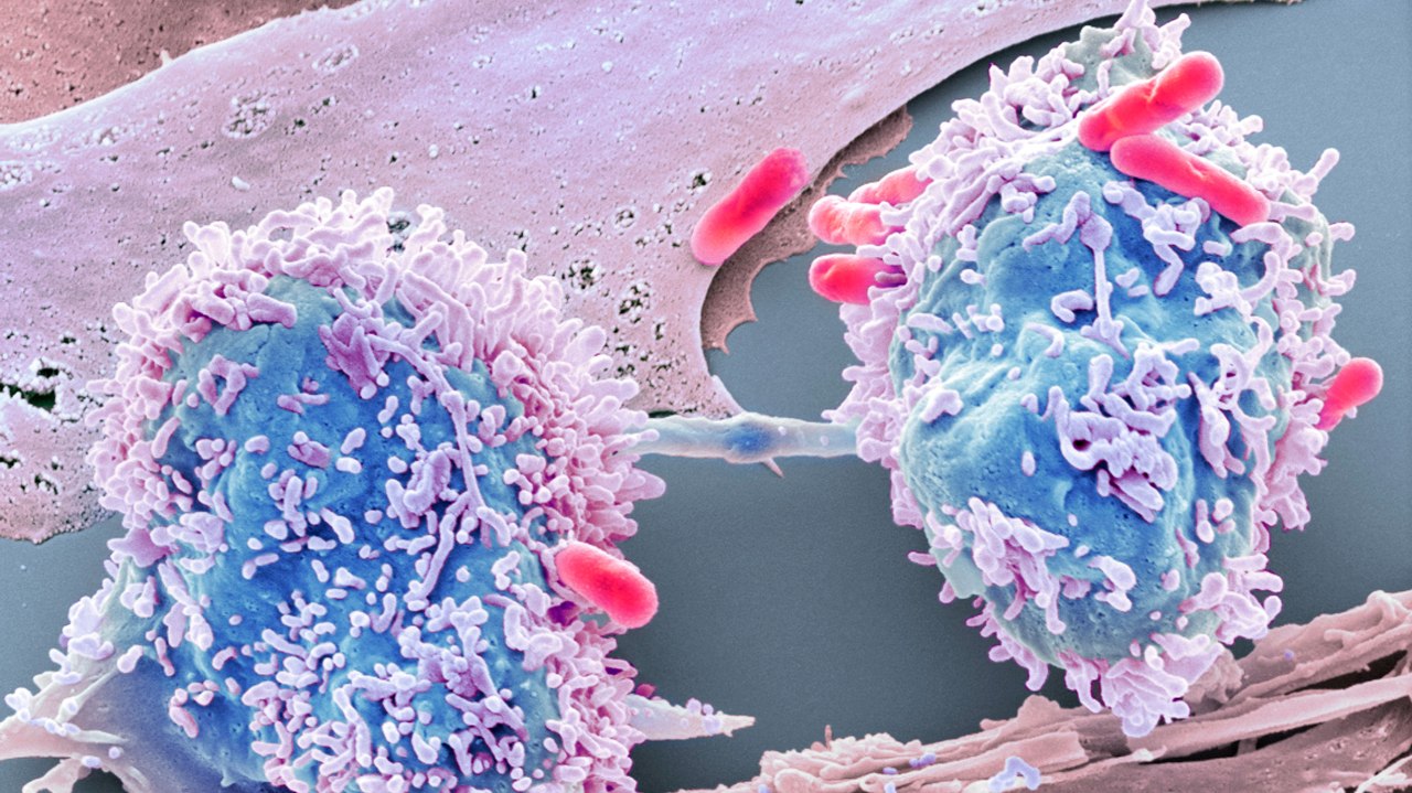 Harnessing Data Science to Revolutionize Cancer Research