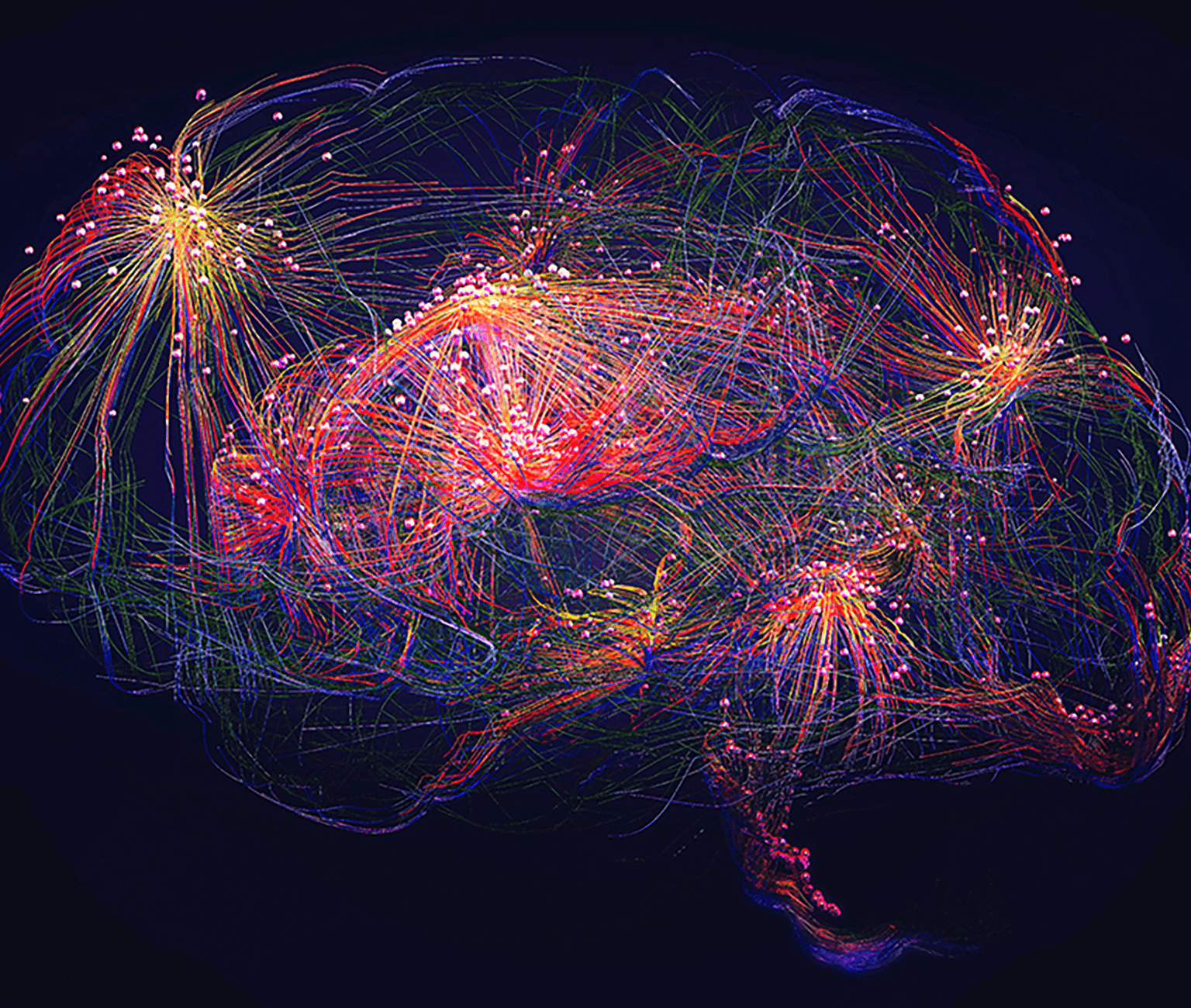 Neuromorphic NLP